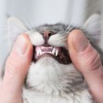 periodontitis
