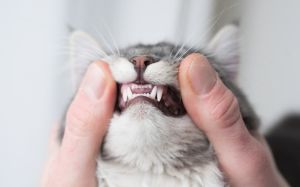 periodontitis