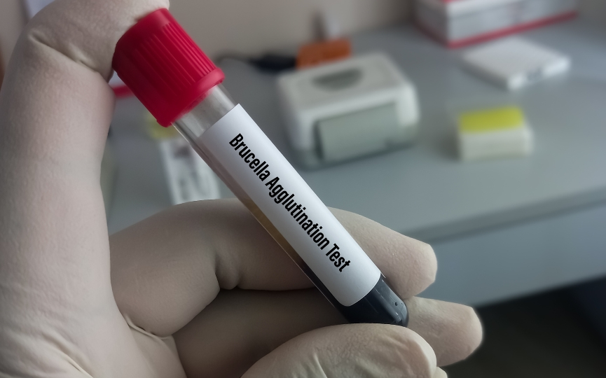 brucella test