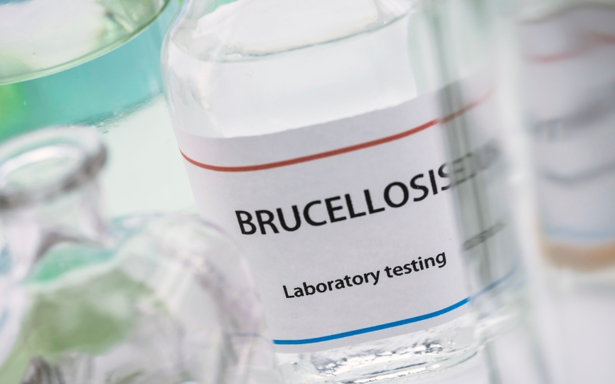 brucelosis