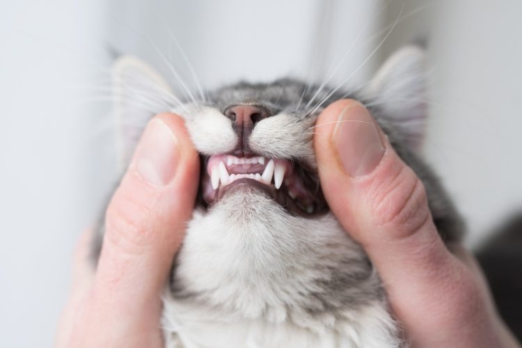 periodontitis